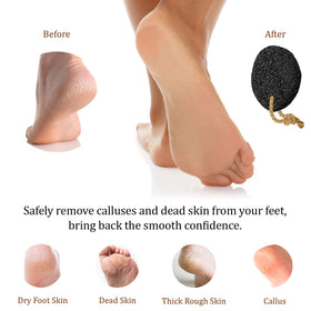 Pumice Valley held in hand to show size and precise control for treatment
