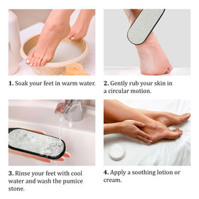 Pumice Valley in use on heel showing targeted callus removal benefit