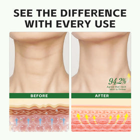 PUQIANNA applied to neck highlighting smoother, firmer look