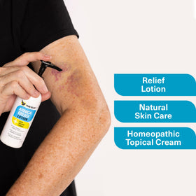 Applying Pure Relief arnica cream to bruised arm to reduce swelling