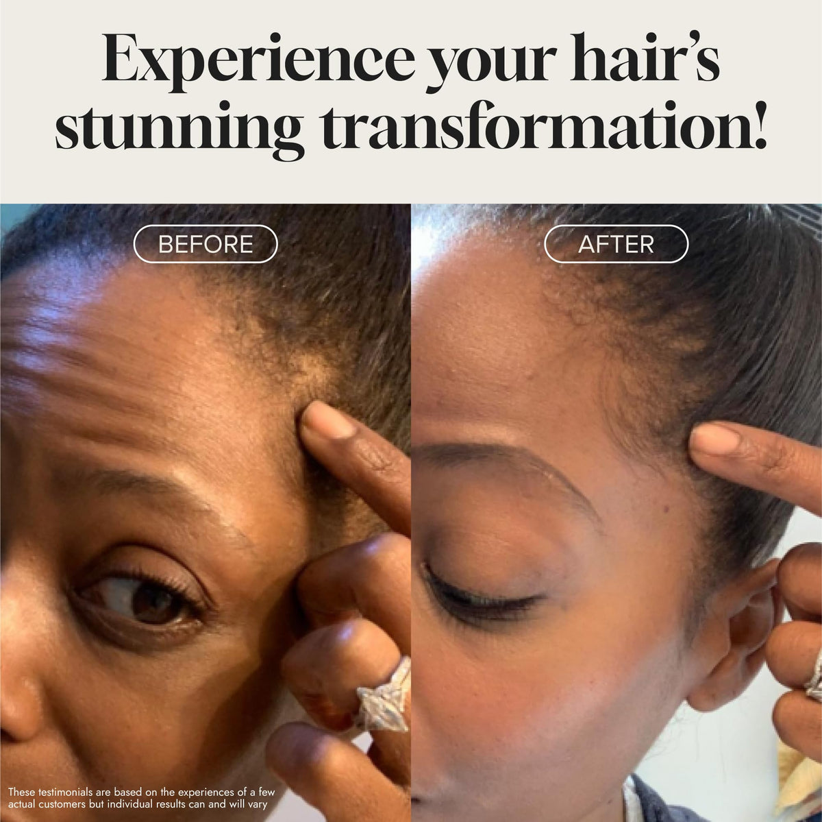 Meraz Pureauty Naturals applying serum to scalp to target thinning areas