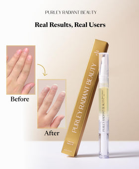 Purely Radiant twistable pen applicator close-up for precise cuticle dosing