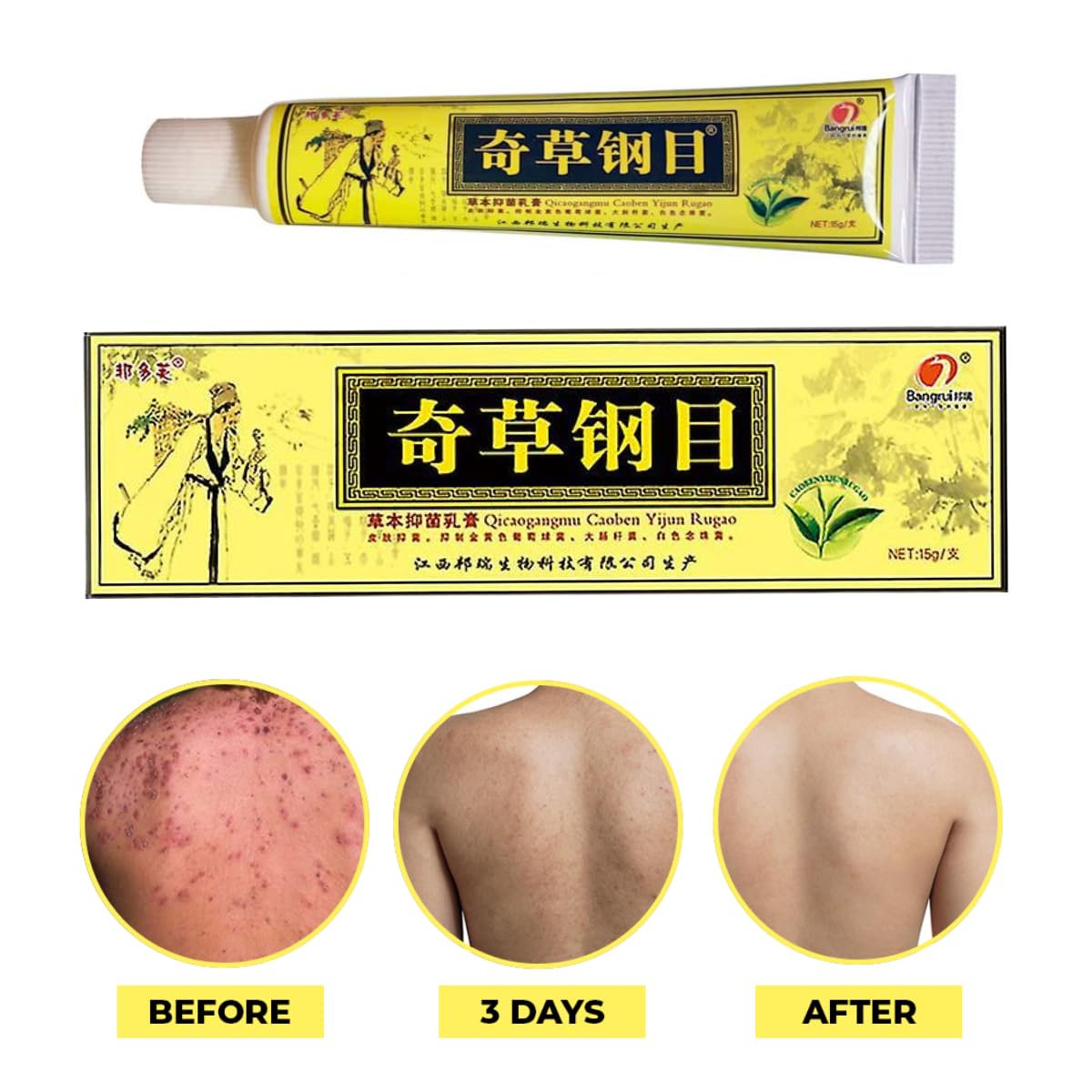 QICAOGANGMU tube close-up of label highlighting natural herbal formula benefit