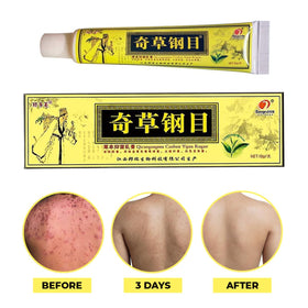 QICAOGANGMU tube close-up of label highlighting natural herbal formula benefit