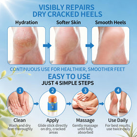QKCXHB being applied to heel demonstrating targeted callus care