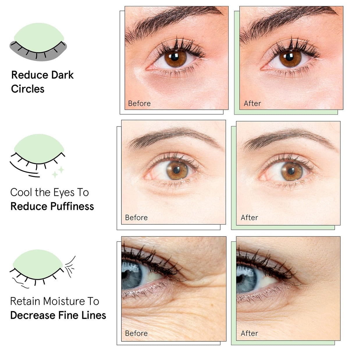 QUIA patch applied under eye demonstrating secure no-slip fit benefit