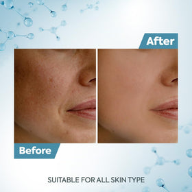 Raaga Professional applied to cheek illustrating even coverage and de-tan action