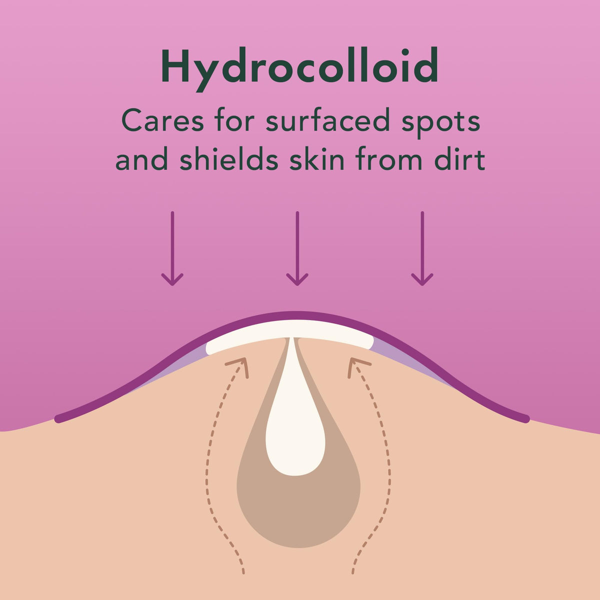 Rael patch applied on cheek overnight protecting blemish and reducing picking