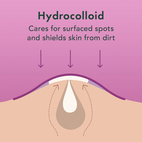 Rael patch applied on cheek overnight protecting blemish and reducing picking