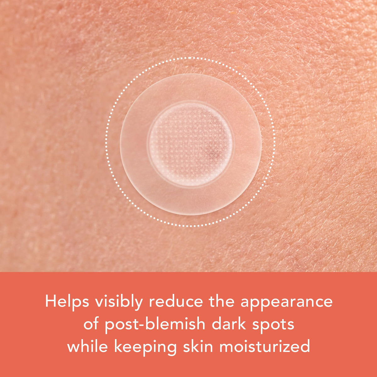 Rael patch applied to cheek protecting blemish while reducing picking