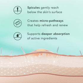 Rael top-down spicule illustration showing azelaic acid release for clearer pores