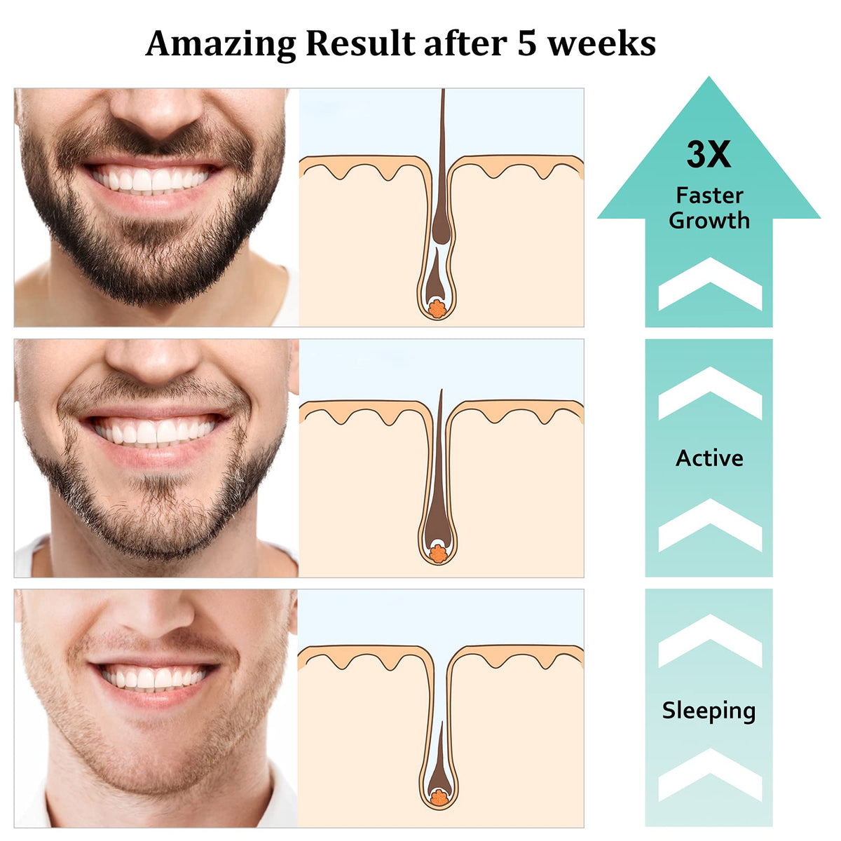 RAFFIN before and after scale comparison demonstrating fuller beard