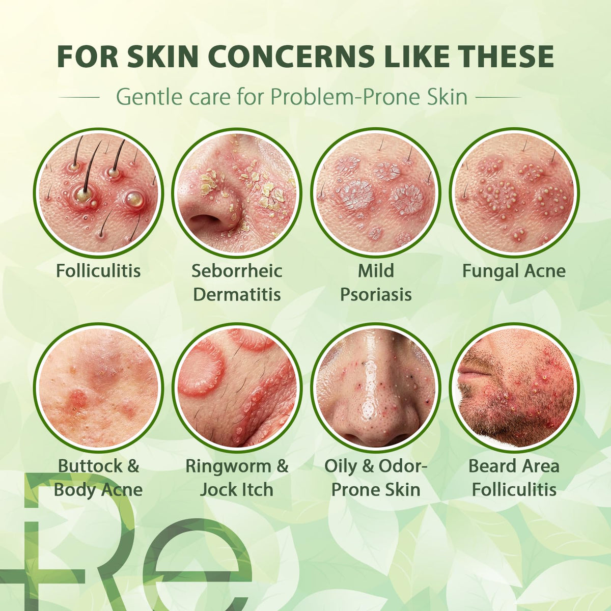Arrangement of botanical extracts representing Recuren Plus key ingredients and antimicrobial support