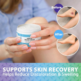 Applying Recuren Plus to knee area after activity to soothe swelling and muscle soreness