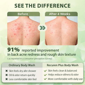 Person applying Recuren Plus in shower to back area for targeted acne and odor control
