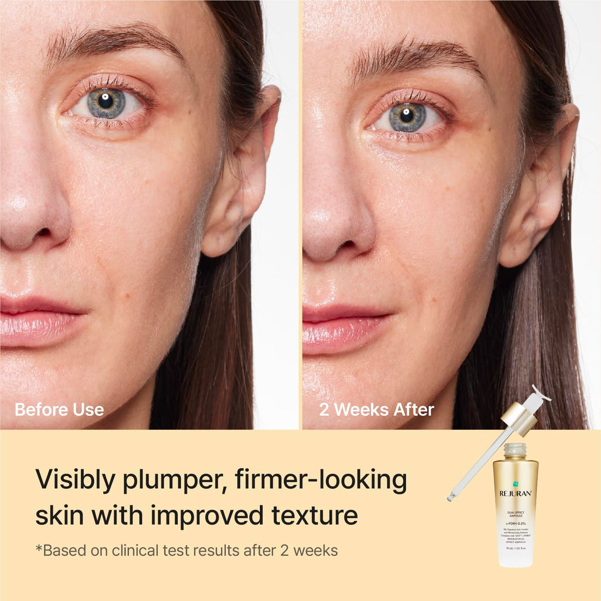 REJURAN ampoule held in hand to show size and travel-friendly benefit