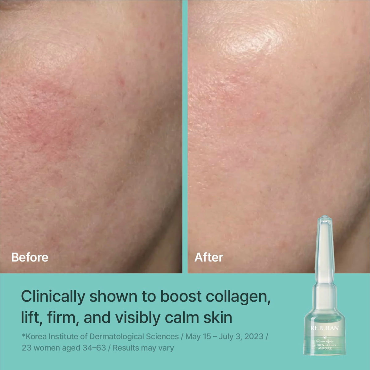 REJURAN serum texture closeup showing lightweight hydrating finish