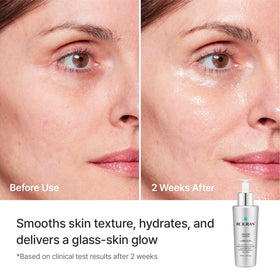 REJURAN ampoule in hand showing size and easy portability benefit