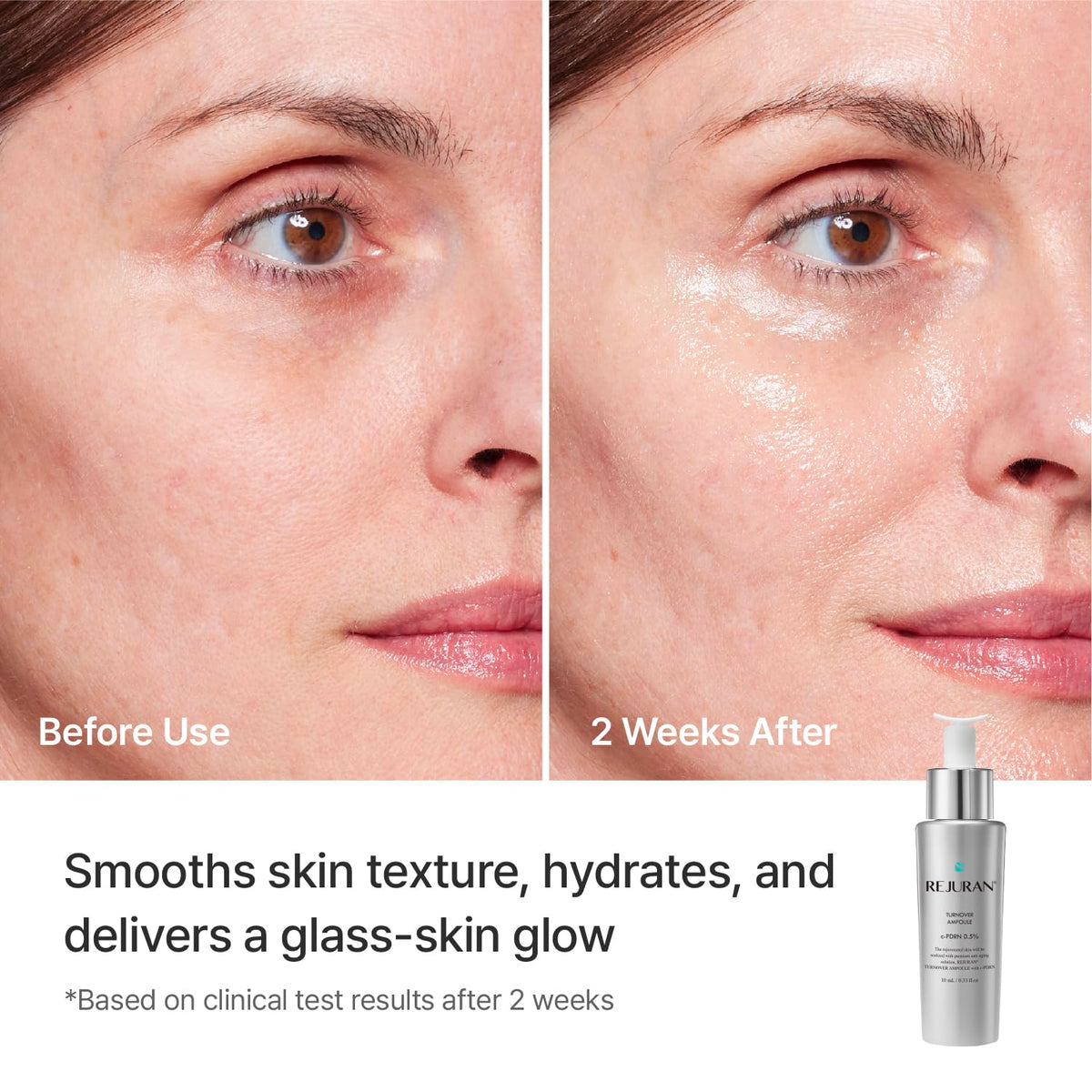 REJURAN c-PDRN ingredient visual communicating targeted repair benefit