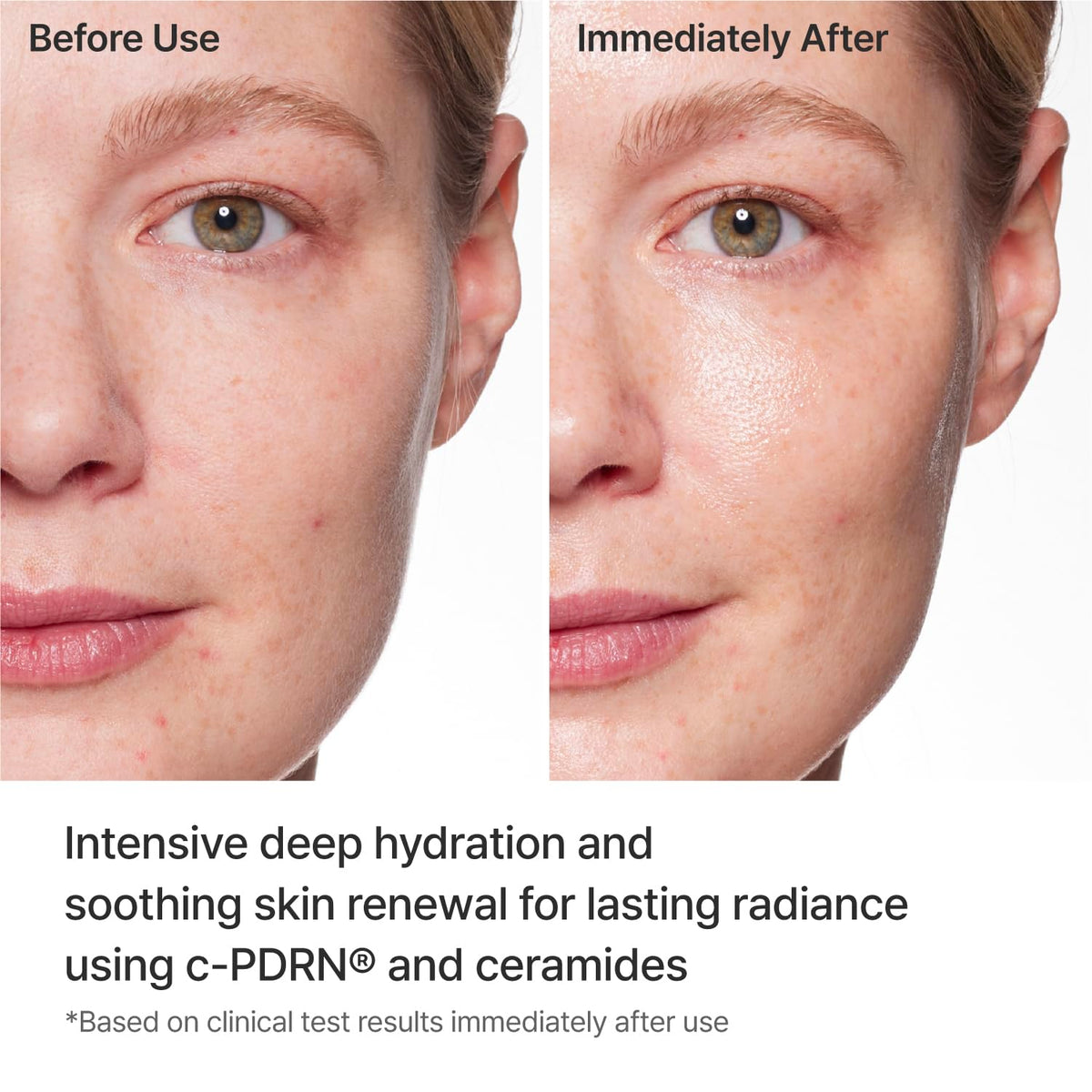 REJURAN mask applied on model demonstrating a snug fit and soothing effect