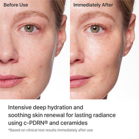REJURAN mask applied on model demonstrating a snug fit and soothing effect