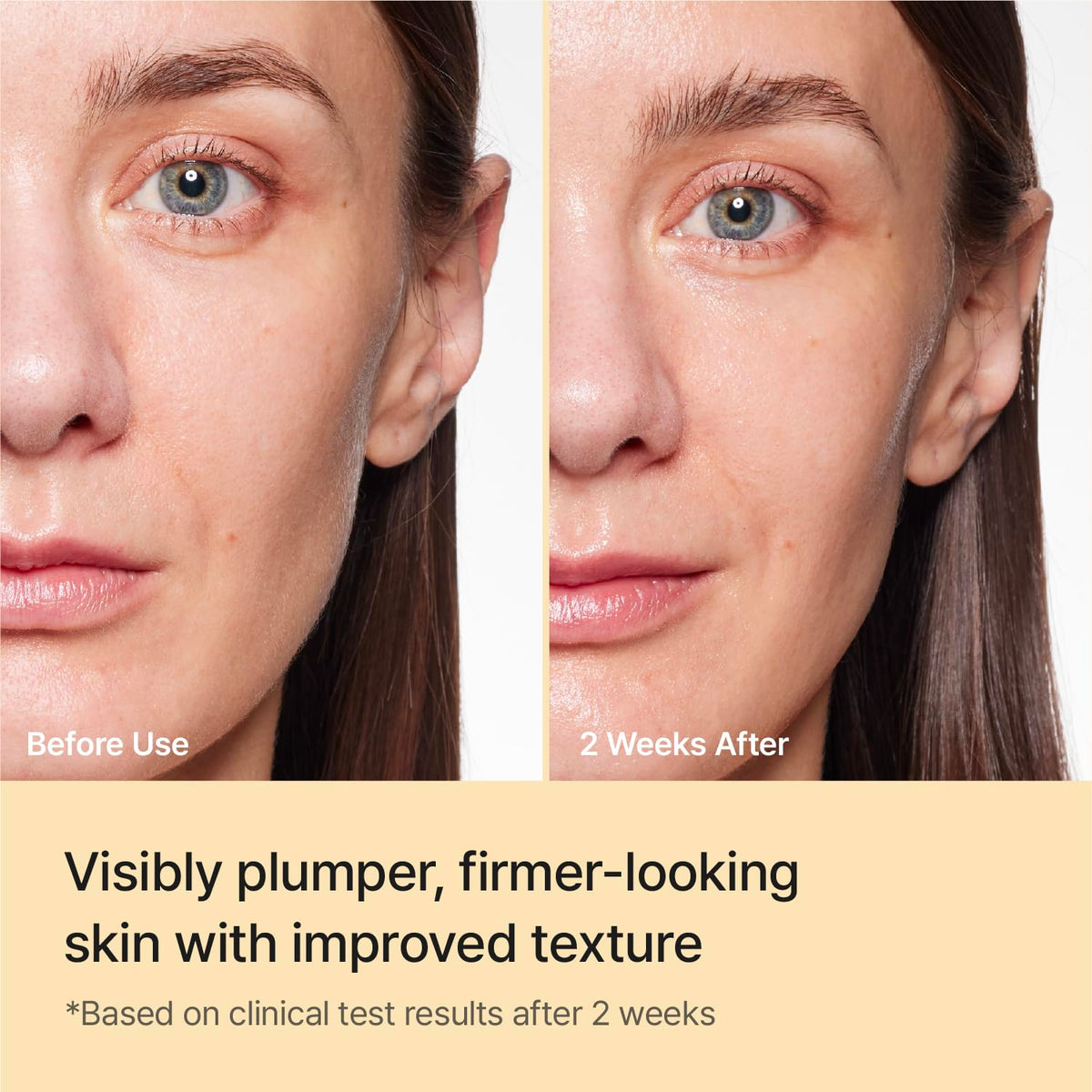 REJURAN ampoule in hand showing 10mL travel scale and portability benefit
