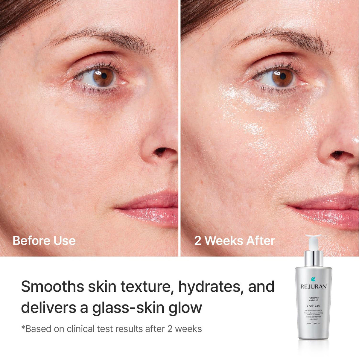 REJURAN size comparison with everyday object to show 1.69 fl oz capacity and value benefit