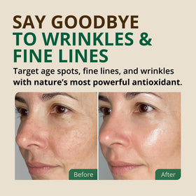 RejuveNaturals hand applying oil to skin demonstrating improved softness