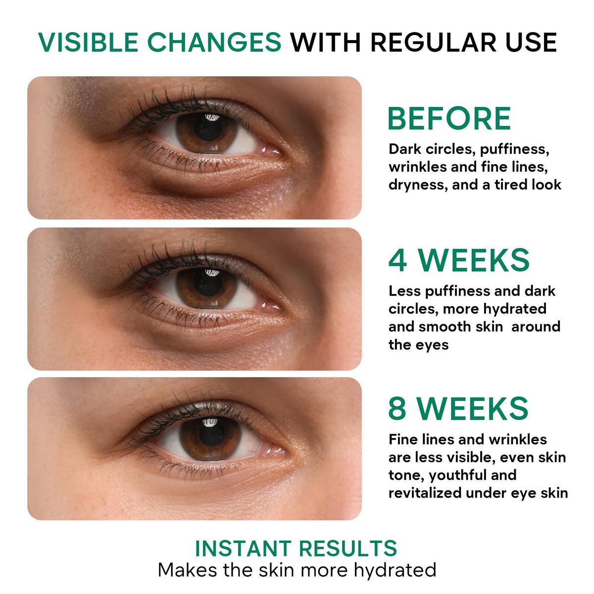 REMEDIAL PAXWELL application demo patting under-eye for reduced puffiness