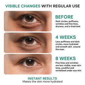 REMEDIAL PAXWELL application demo patting under-eye for reduced puffiness
