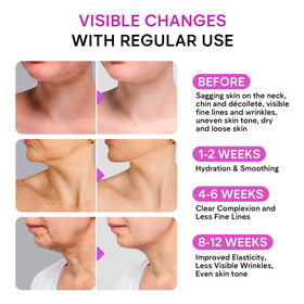 REMEDIAL PAXWELL on décolleté in lifestyle setting showing smooth skin benefit: hydrated appearance