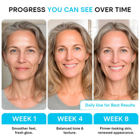 REMEDIAL PURITY AESTHETICS EXPERIENCE cream applied to neck demonstrating firming support