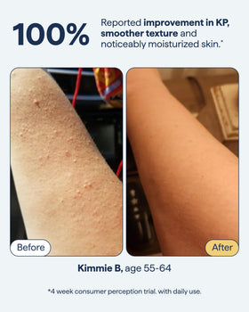 Remedy Science active ingredient icons showing retinol, urea, lactic acid benefits