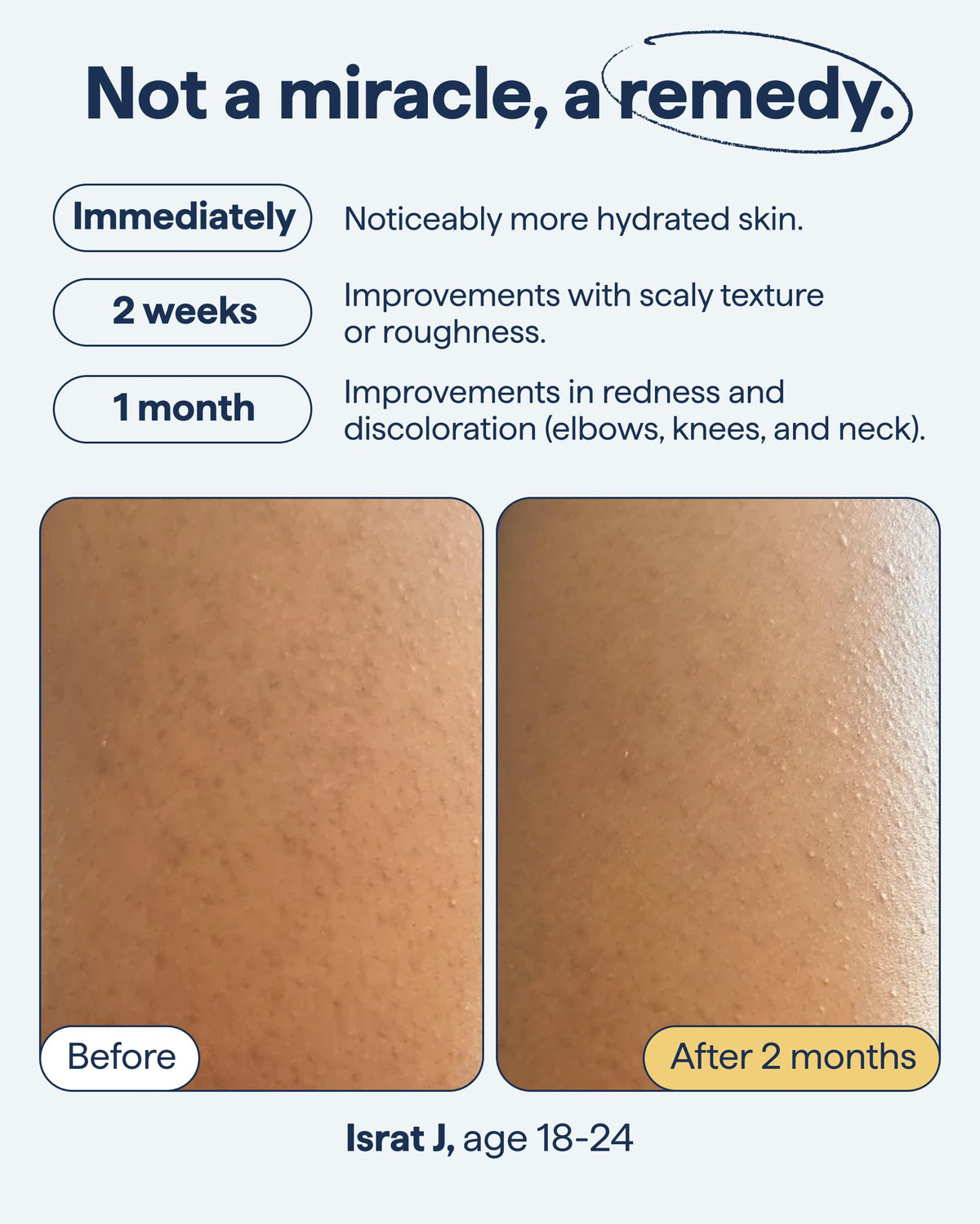 Remedy Science applied to arm showing how to treat textured areas