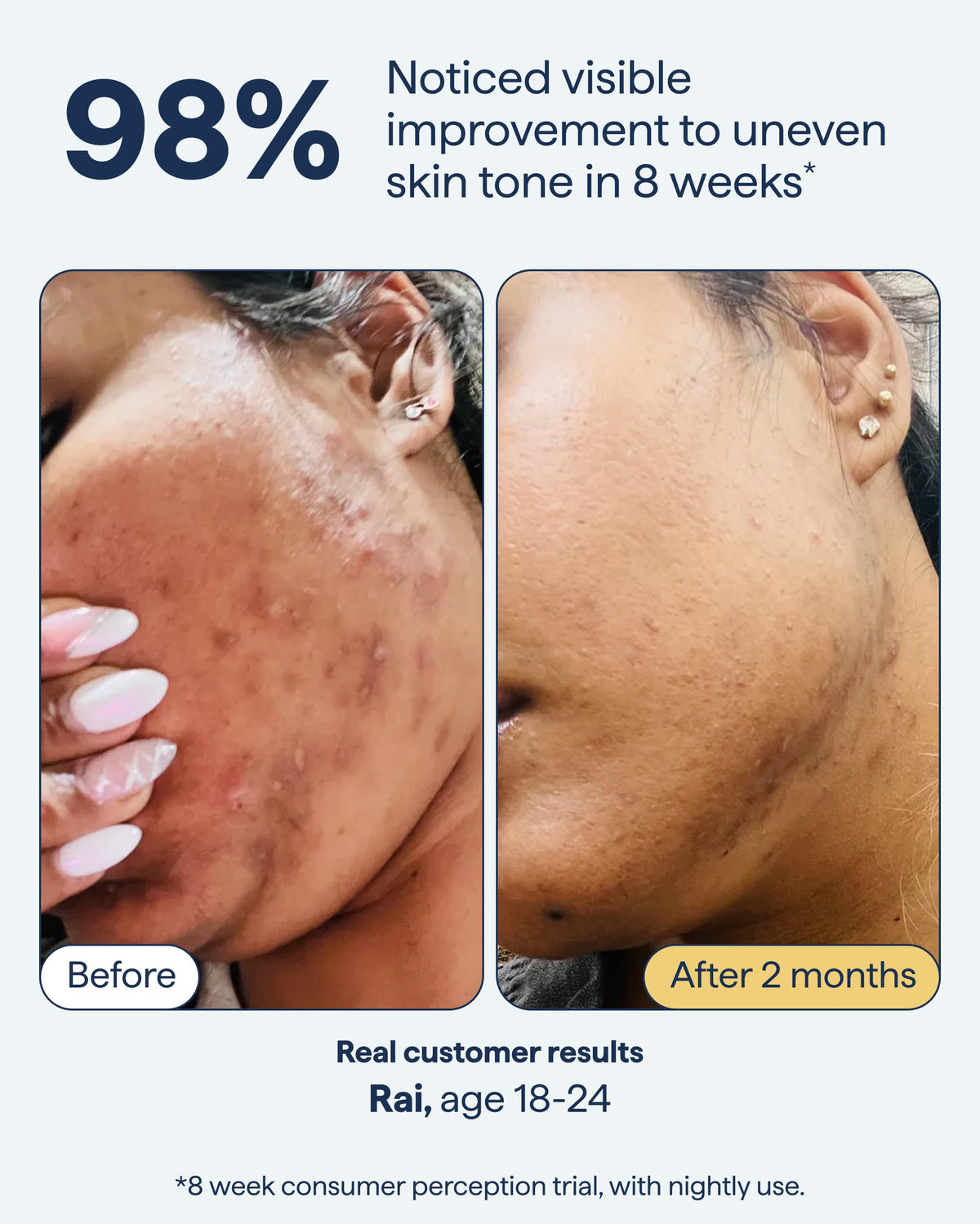 Remedy Science before-after illustration suggesting improved discoloration over time