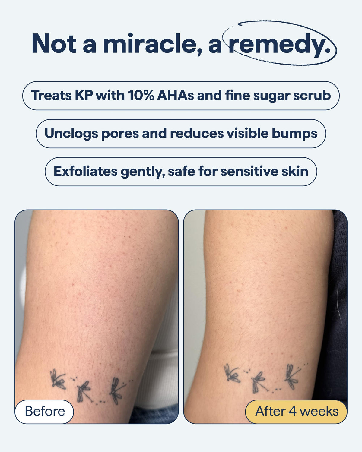 Remedy Science product spread on skin demonstrating smoothing action
