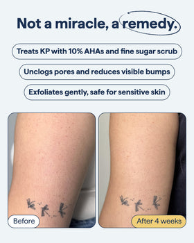 Remedy Science product spread on skin demonstrating smoothing action