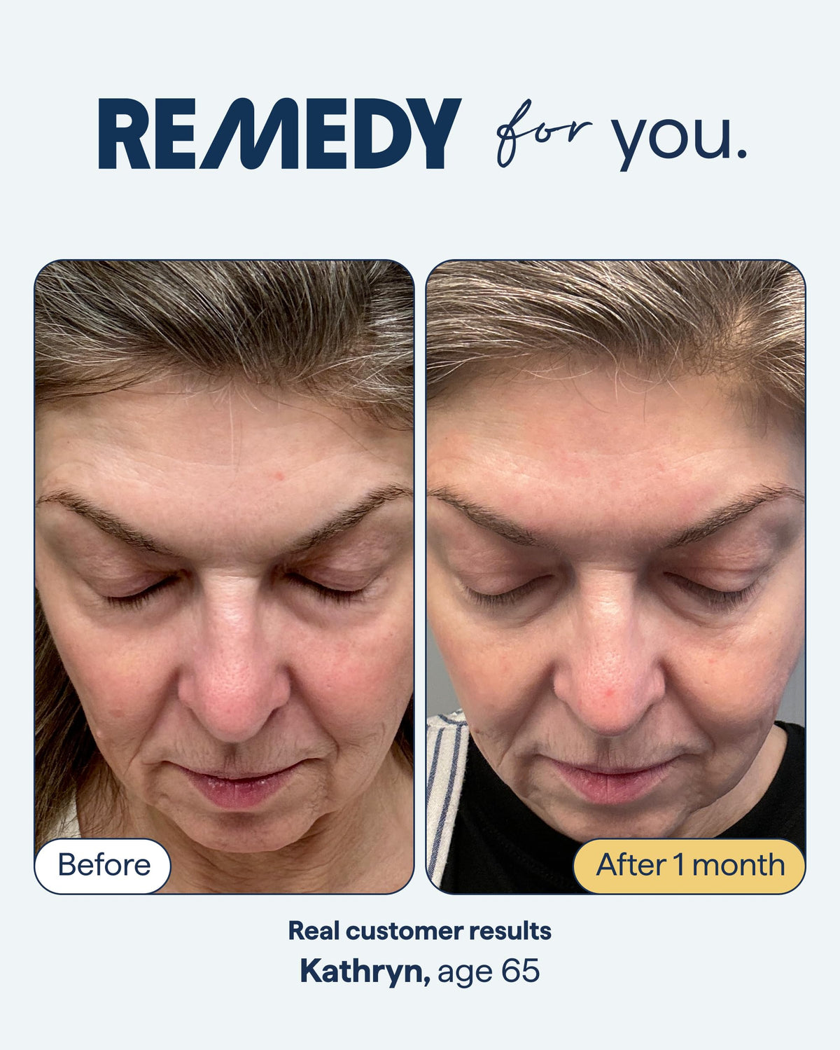 Remedy Science gel-lotion texture on fingertip, demonstrates fast absorption