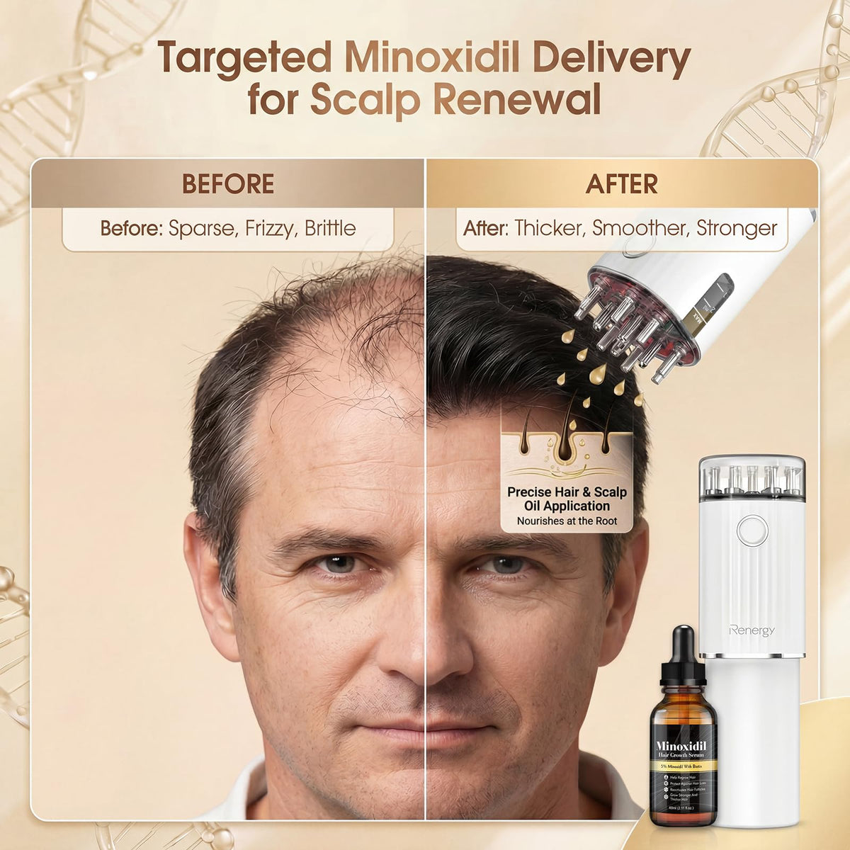 Renergy visible 2ml dosage scale on reservoir for measured topical application