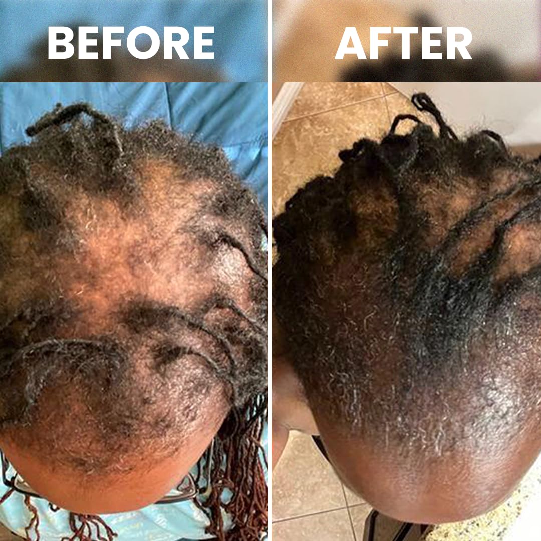 Rennora Beauty lifestyle image of woman applying serum for everyday hair care