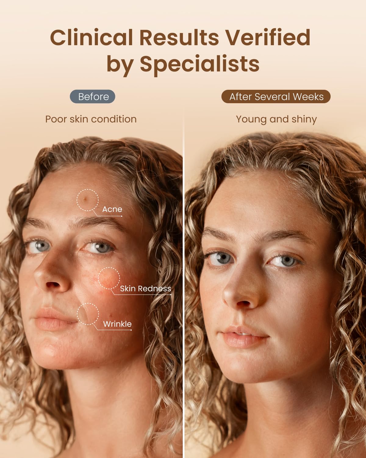 RENPHO silicone texture detail showing skin-friendly material and comfort