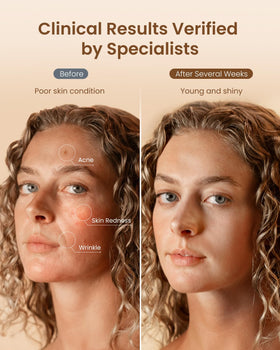 RENPHO silicone texture detail showing skin-friendly material and comfort