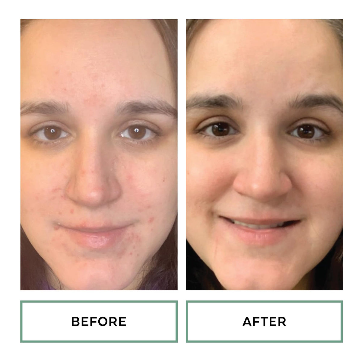 Hand applying Replenix pad to cheek demonstrating easy, no-rinse use