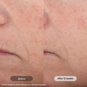 Revision Skincare Intellishade Matte applied on hand for quick coverage demonstration