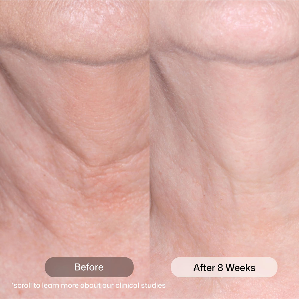 Revision Skincare Nectifirm close-up texture displaying rich hydrating cream