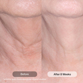 Revision Skincare Nectifirm close-up texture displaying rich hydrating cream