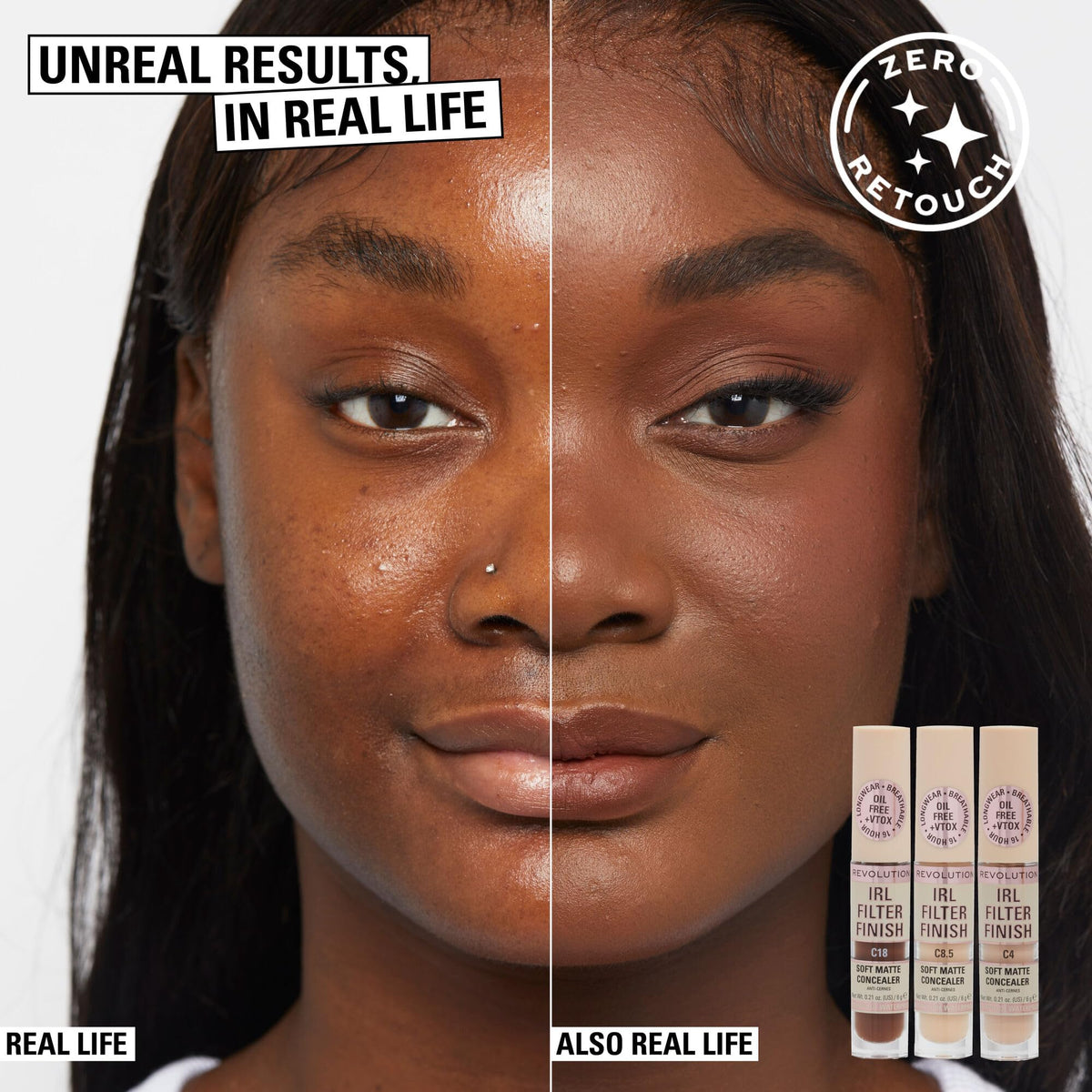 Revolution concealer before and after photo demonstrating full coverage