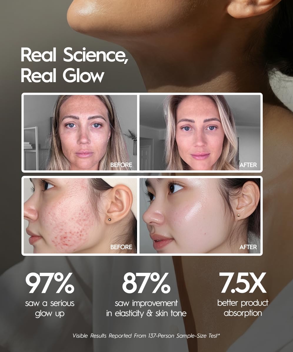 REVOMADIC REVO Genie illuminated red blue green LED lights for targeted skin goals