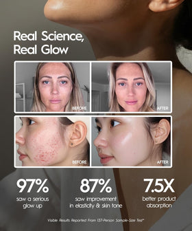 REVOMADIC REVO Genie illuminated red blue green LED lights for targeted skin goals