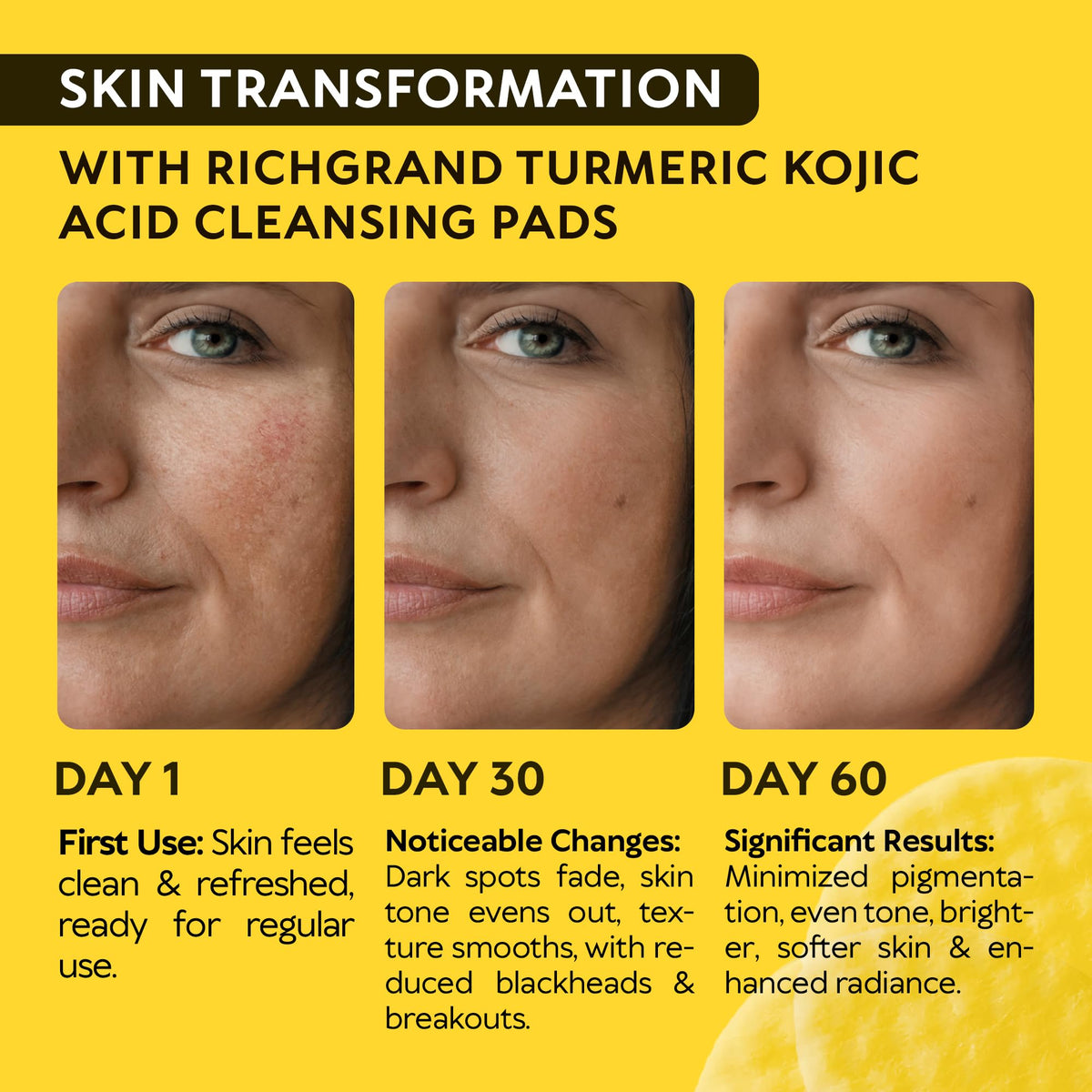RICHGRAND close-up of pad texture highlighting gentle exfoliation benefit